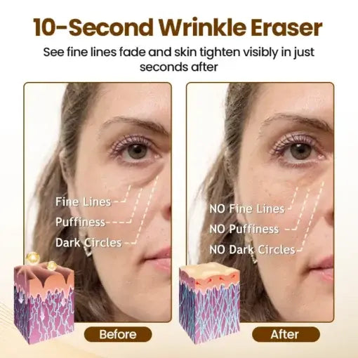 Biancat® Liftora 10s Wrinkle Serum Roller | Removes 97% of under-eye bags in 60 seconds — Instantly look 10 years younger!