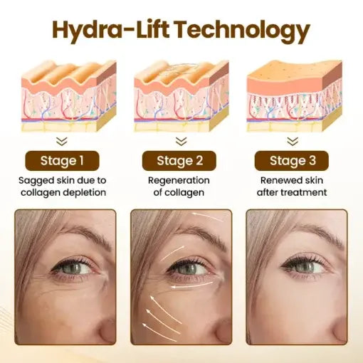 Biancat® Liftora 10s Wrinkle Serum Roller | Removes 97% of under-eye bags in 60 seconds — Instantly look 10 years younger!